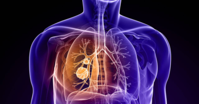 Estas son las principales señales de alarma del cáncer de pulmón