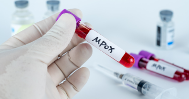 OMS sustituye nombre de viruela del mono por mpox