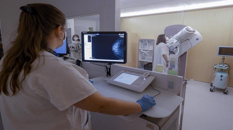 Descubren cómo predecir la eficacia de uno de los fármacos más usados contra el cáncer de mama
