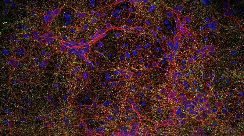 Prevén utilizar nanotecnología para reparar lesiones medulares