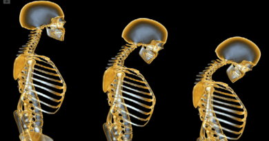 Revelan que la contaminación del aire de EE.UU. representa riesgo de padecer osteoporosis