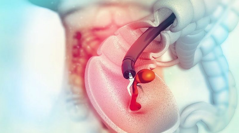 Té de menta ayuda a desinflamar el colon