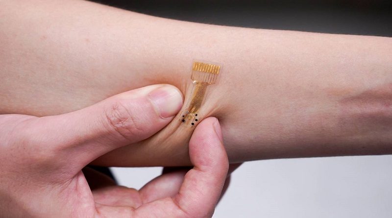 Crean parche bioelectrónico para curar heridas crónicas