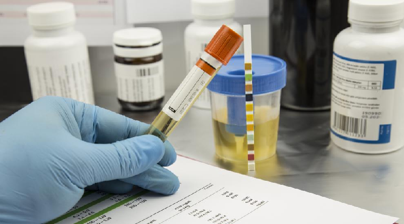 Desarrollan test genético que puede detectar el cáncer de vejiga años antes de su aparición