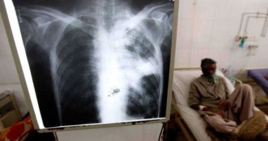 OPS alerta sobre avance de casos de tuberculosis en las Américas
