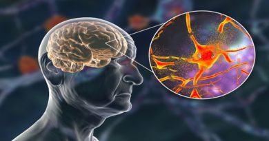 Cambios de ánimo constantes puede ser señal de Alzheimer