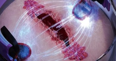 Desarrollan biochip que ayuda a curar heridas más rápidamente
