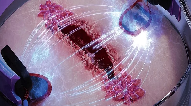 Desarrollan biochip que ayuda a curar heridas más rápidamente