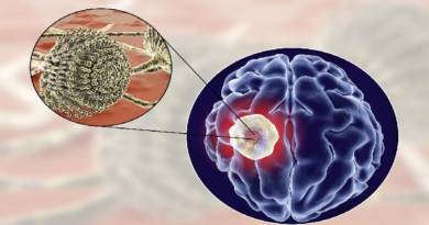 Desarrollan investigación por aumento de casos de abscesos cerebrales en EE.UU.