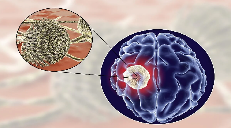 Desarrollan investigación por aumento de casos de abscesos cerebrales en EE.UU.