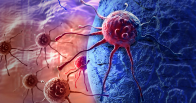 Nueva Tecnología permite detectar células cancerígenas en la orina