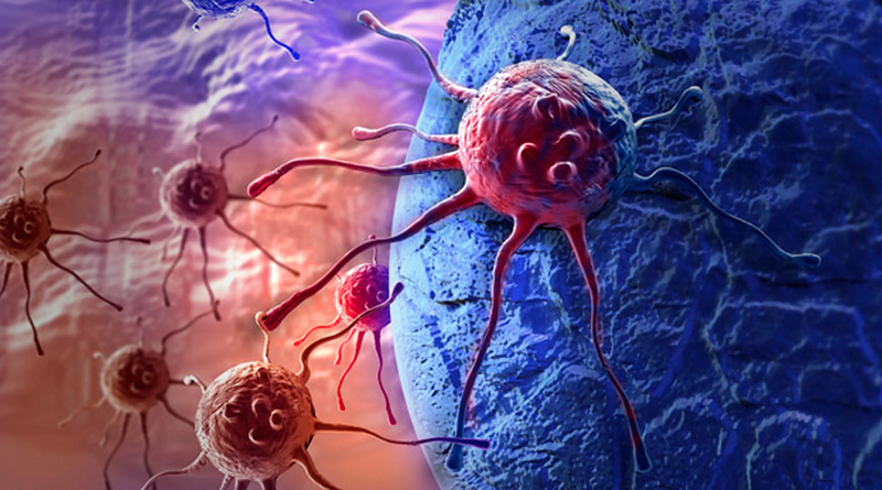 Nueva Tecnología permite detectar células cancerígenas en la orina