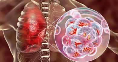 OMS lanza plataforma digital para brindar mayor atención al tema de tuberculosis