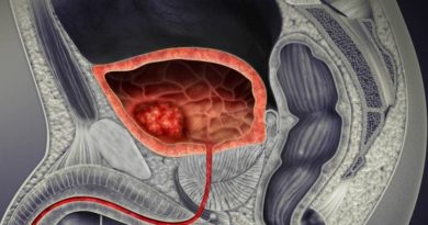 Pérdida del cromosoma Y favorece el crecimiento del cáncer