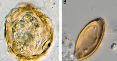Encuentran huevos de helminto en paleoheces de antiguos mineros de sal