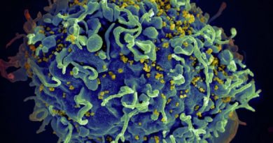 Descubren variante genética que parece limitar infección por VIH
