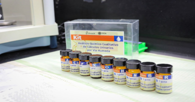 Científicos crean kit para diagnosticar cálculos renales por vía húmeda