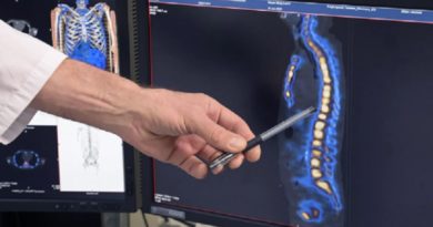 Descubre qué es la escoliosis lumbar y cuáles son sus síntomas