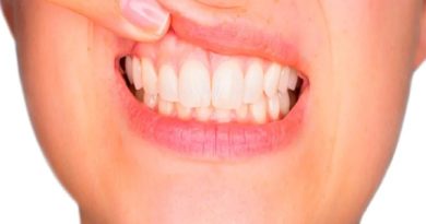 Estrés: respuesta física y mental que también puede afectar la salud dental