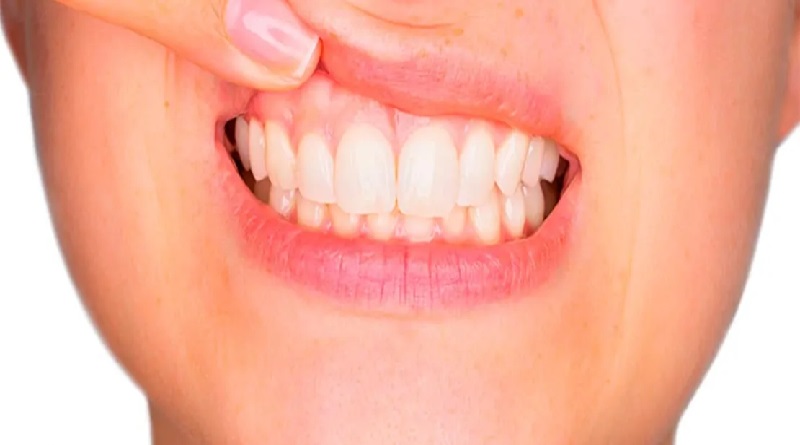 Estrés: respuesta física y mental que también puede afectar la salud dental