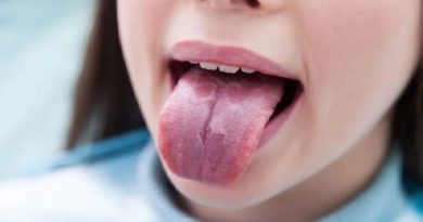 Mal aspecto de la lengua puede ser señal de enfermedades