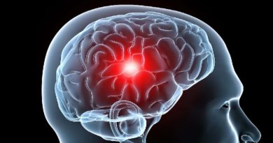 Niños en edad escolar pueden sufrir de migraña