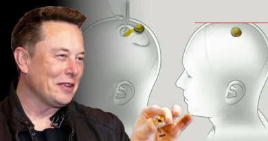 Empresa Neuralink comienza reclutamiento de voluntarios para implantes cerebrales