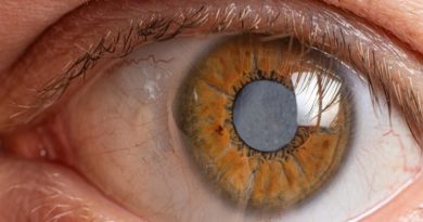 ¿Qué es el glaucoma y cómo evitarlo?