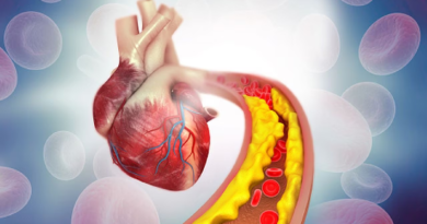Consumir esta planta favorece la salud cardiovascular