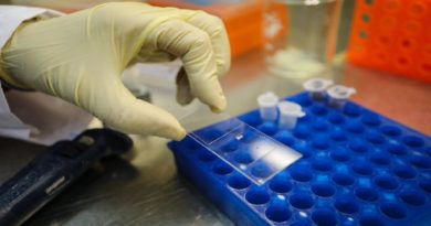 Científicos venezolanos crean kit para la detección temprana de cáncer de mama