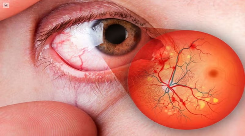 Convierten células de la retina en neuronas para recuperar la vista en humanos