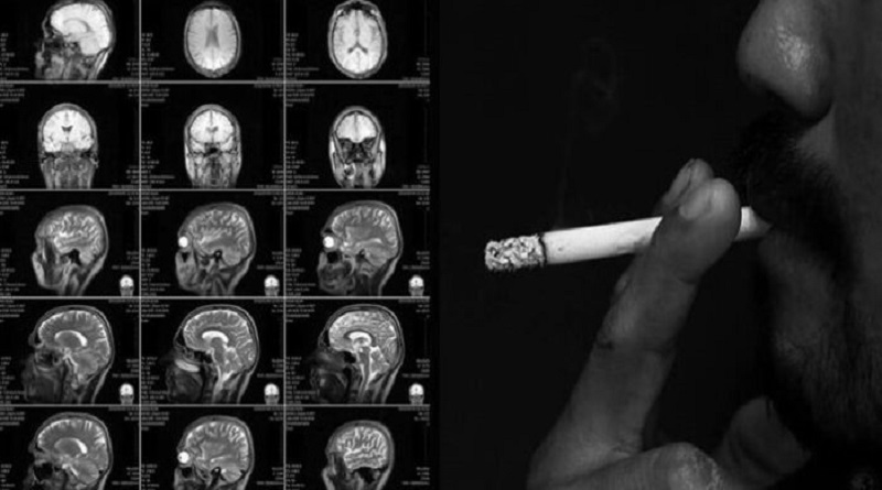 Estudio demuestra que el tabaquismo afecta al cerebro