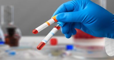 Desarrollan test de sangre para calcular envejecimiento de los órganos