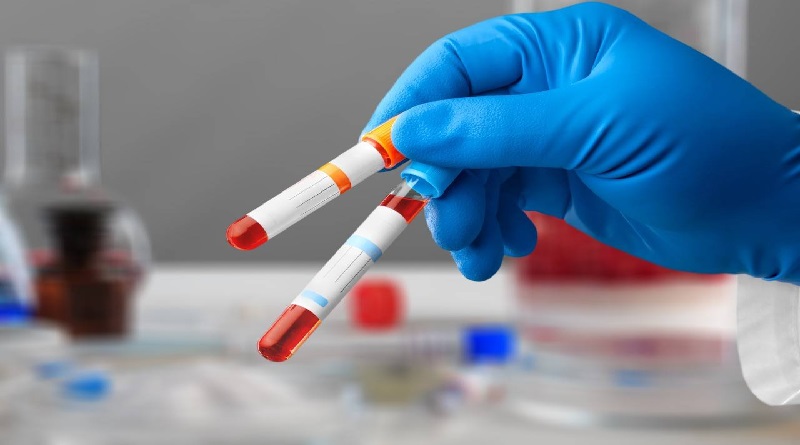 Desarrollan test de sangre para calcular envejecimiento de los órganos