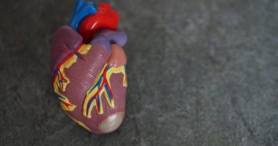 Identifican gen causante de defectos cardíacos en personas con Síndrome de Down