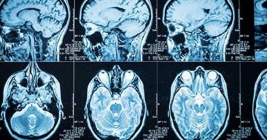 El cerebro encuentra formas de compensar el deterioro relacionado con la edad