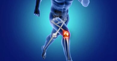 Estudio revela que cristales de calcio en la rodilla acelera la artritis