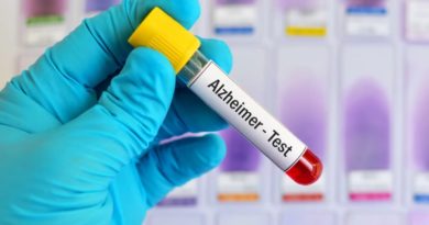 Identifican nuevas variantes genéticas asociadas a la enfermedad de Alzheimer