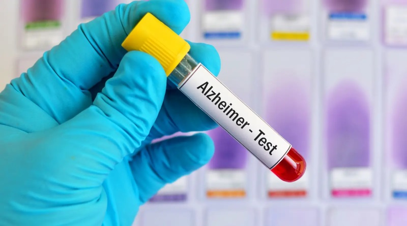 Identifican nuevas variantes genéticas asociadas a la enfermedad de Alzheimer