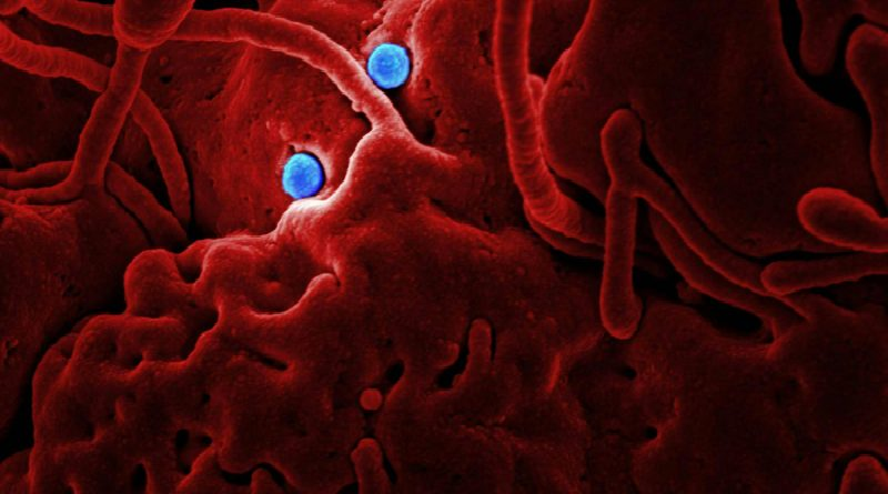 Descubren "bacterias mutantes" en Estación Espacial Internacional