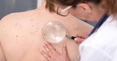 El melanoma rompe genes para resistir a la acción de los fármacos