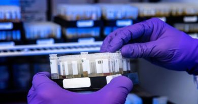 Conoce el nuevo software con IA que permite diagnosticar la sepsis