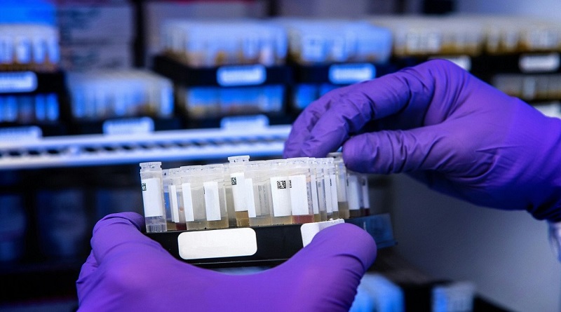 Conoce el nuevo software con IA que permite diagnosticar la sepsis