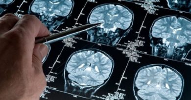 Desarrollan en España una IA que precisa el padecimiento de Alzheimer