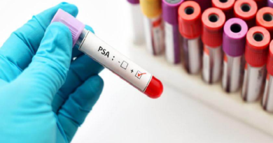 Venezuela mantiene política de salud pública para tratar cáncer de próstata