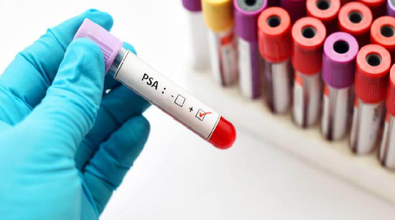 Venezuela mantiene política de salud pública para tratar cáncer de próstata