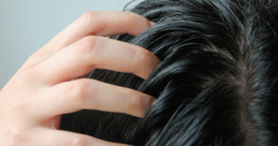 Conozca los tips para eliminar la grasa del cabello