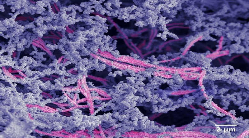 Desarrollan biomaterial que regenera cartílago dañado en articulaciones