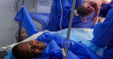 Realizan primera cesárea segmentaria en Hospital Susana Maduro en Falcón