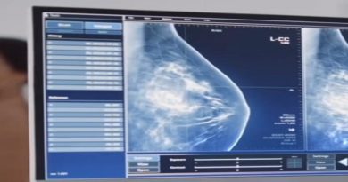 venezuela-software-detecta-cancer-mama-tiroides